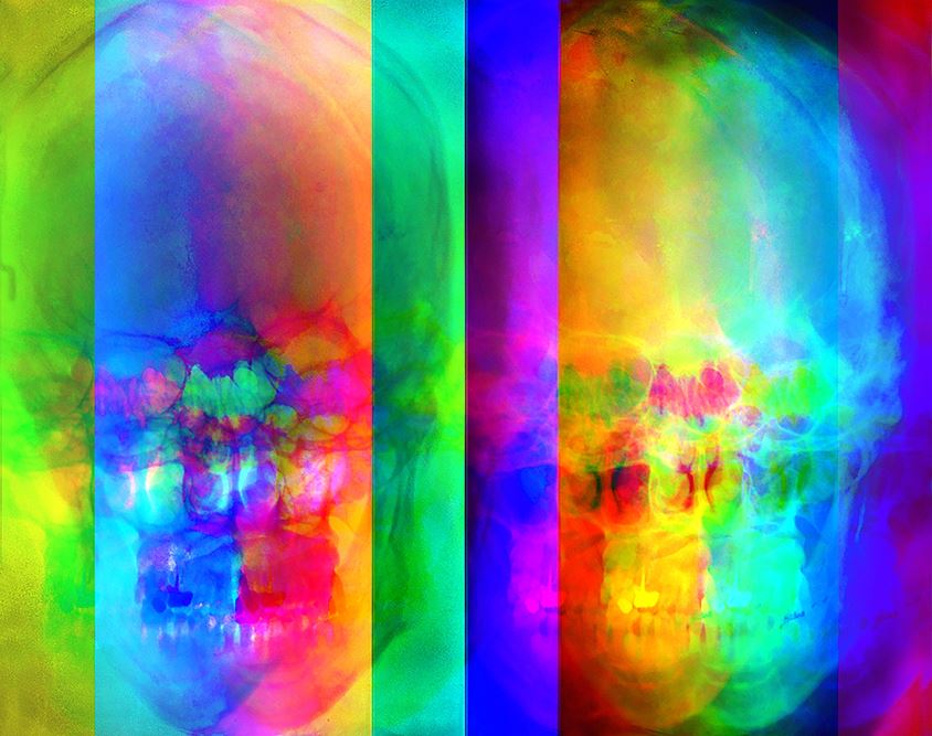 My Skull (X-Ray), The Re-Emergence of Light Series
